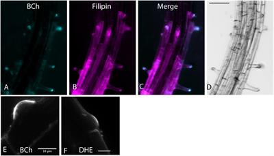 The Sterol Trafficking Pathway in Arabidopsis thaliana